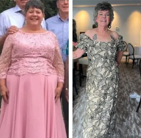 Audrey Bariatric