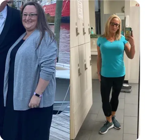 Erin Bariatric